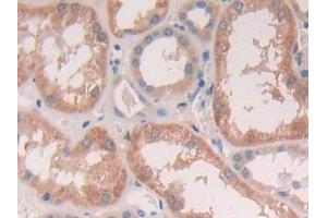 Detection of CTSS in Human Kidney Tissue using Polyclonal Antibody to Cathepsin S (CTSS) (Cathepsin S anticorps  (AA 115-331))