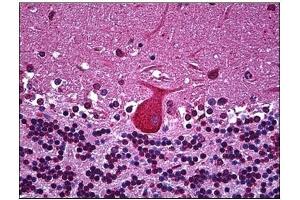 Immunohistochemistry (IHC) image for anti-Tumor Necrosis Factor alpha (TNF alpha) (AA 1-234) antibody (ABIN782382)