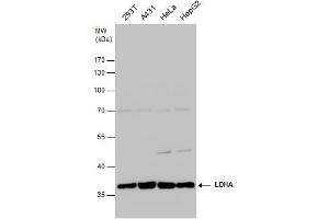 WB Image LDHA antibody detects LDHA protein by western blot analysis.