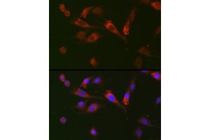 Immunofluorescence analysis of BALB-3T3 cells using GDF15 Rabbit pAb (ABIN3020658, ABIN3020659, ABIN3020660, ABIN1512942 and ABIN6213652) at dilution of 1:100 (40x lens). (GDF15 anticorps  (AA 49-308))