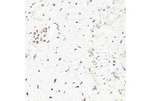 Immunohistochemistry of paraffin-embedded human uterus using FKBP5 antibody.