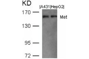 Image no. 1 for anti-Met Proto-Oncogene (MET) (AA 1001-1005) antibody (ABIN401652) (c-MET anticorps  (AA 1001-1005))
