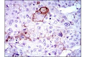 Immunohistochemistry (IHC) image for anti-Lipoprotein (Lp(a)) (AA 4330-4521) antibody (ABIN1845714) (Lp(a) anticorps  (AA 4330-4521))