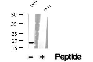 Western blot analysis of extracts of HeLa cells, using SRP14 antibody. (SRP14 anticorps  (Internal Region))