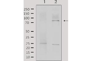 Western blot analysis of extracts from mouse brain, using MTA1 Antibody. (MTA1 anticorps  (Internal Region))