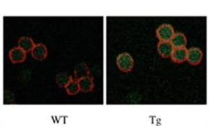 IF staining of Drak2 in WT versus Tg T cells. (DRAK2 anticorps  (C-Term))
