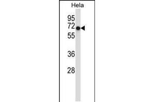 Western blot analysis in Hela cell line lysates (35ug/lane). (ACVR1 anticorps  (AA 137-166))