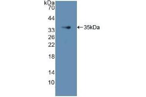 Detection of Recombinant GDI1, Human using Polyclonal Antibody to GDP Dissociation Inhibitor 1 (GDI1) (GDI1 anticorps  (AA 1-274))