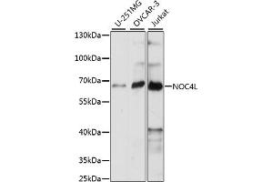 Western blot analysis of extracts of various cell lines, using NOC4L antibody (ABIN7269029) at 1:1000 dilution. (NOC4L anticorps  (AA 1-260))