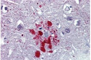 Human Brain, Cortex, Senile Plaque (formalin-fixed, paraffin-embedded) stained with Ubiquitin antibody ABIN462018 at 10 ug/ml followed by biotinylated anti-mouse IgG secondary antibody ABIN481714, alkaline phosphatase-streptavidin and chromogen.