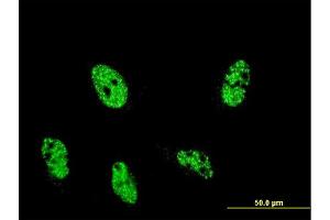 Immunofluorescence of monoclonal antibody to ARID4A on HeLa cell. (ARID4A anticorps  (AA 1033-1139))