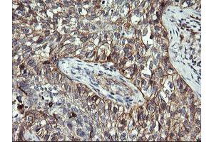 Immunohistochemistry (IHC) image for anti-T-cell surface glycoprotein CD1c (CD1C) antibody (ABIN2670676) (CD1c anticorps)