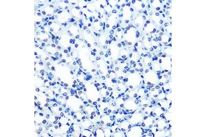 Immunohistochemistry of paraffin-embedded mouse kidney using  Rabbit mAb (ABIN7265458) at dilution of 1:100 (40x lens). (ADAR anticorps)