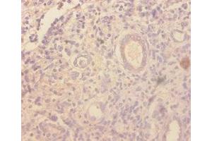 Immunohistochemistry of paraffin-embedded human kidney tissue using ABIN7177029 at dilution of 1:100 (CCL4 anticorps  (AA 24-92))