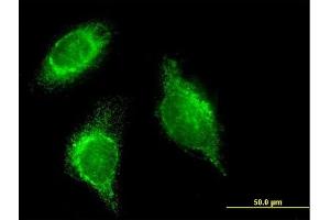 Immunofluorescence of monoclonal antibody to SFTPD on HeLa cell. (SFTPD anticorps  (AA 21-375))