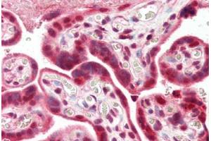 Human Placenta (formalin-fixed, paraffin-embedded) stained with PARP1 antibody ABIN462086 followed by biotinylated goat anti-rabbit IgG secondary antibody ABIN481713, alkaline phosphatase-streptavidin and chromogen.