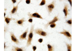 Anti-Apoptosis inhibitor 5 antibody, ICC ICC: HELA Cell