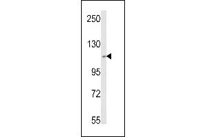 Western blot analysis of SKIV2L2 Antibody (Center) (ABIN652687 and ABIN2842458) in MCF-7 cell line lysates (35 μg/lane). (MTR4 anticorps  (AA 237-263))