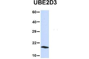 Host:  Rabbit  Target Name:  UBE2D3  Sample Type:  293T  Antibody Dilution:  1.