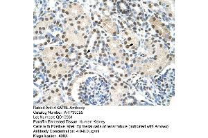 Human kidney (AKAP8L anticorps  (C-Term))