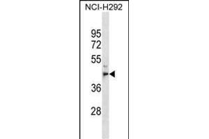 PE1 Antibody (C-term) (ABIN1536963 and ABIN2850052) western blot analysis in NCI- cell line lysates (35 μg/lane). (MPPE1 anticorps  (C-Term))