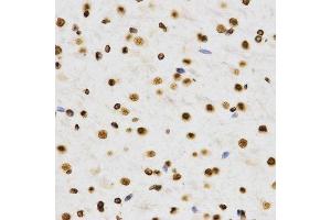 Immunohistochemistry (IHC) image for anti-Histone H3 (H3) (H3K9me2) antibody (ABIN3023260)