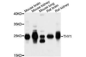 Western blot analysis of extracts of various cell lines, using THY1 antibody. (CD90 anticorps  (AA 20-130))