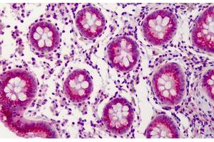 Anti-PPAR Delta antibody IHC of human colon. (PPARD anticorps  (AA 39-54))