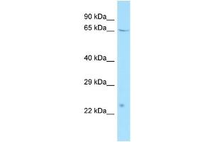 WB Suggested Anti-ATF7IP2 Antibody Titration: 1. (ATF7IP2 anticorps  (N-Term))