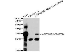 Immunoprecipitation analysis of 200ug extracts of 293 cells treated by PMA using 2. (RPS6 anticorps  (pSer240, pSer244))