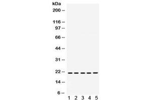 Western blot testing of 1) rat brain, 2) rat liver, 3) rat kidney, 4) human MCF7 and 5) human SW620 lysate with RAPA1 antibody. (RAP1A anticorps)