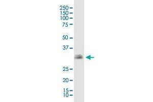 EBAG9 monoclonal antibody (M04), clone 4A10.