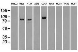 Image no. 6 for anti-B-Raf proto-oncogene, serine/threonine kinase (BRAF) antibody (ABIN1496951)