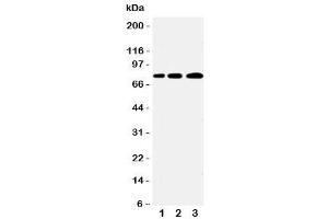 Western blot testing of PLK2 antibody and Lane 1:  A431 (PLK2 anticorps  (C-Term))