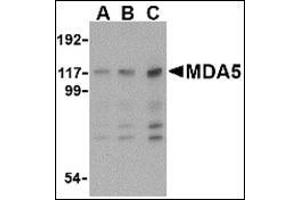 Western blot analysis of MDA5 in Daudi cell lysate with MDA5 antibody at (A) 1, (B) 2 and (C) 4 μg/ml.