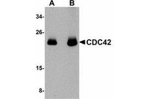 Image no. 1 for anti-Cell Division Cycle 42 (GTP Binding Protein, 25kDa) (CDC42) (N-Term) antibody (ABIN478059) (CDC42 anticorps  (N-Term))