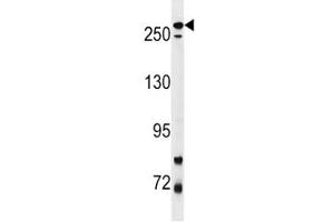 LRRK2 antibody western blot analysis in mouse lung tissue lysate