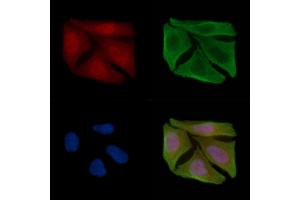 ABIN6255407 and ABIN6267589 staining Hela cells(30 min of UV treatment) by IF/ICC. (RELB anticorps  (pSer573))