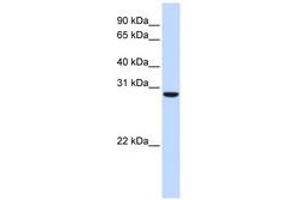Image no. 1 for anti-Chromosome 18 Open Reading Frame 10 (C18orf10) (AA 180-229) antibody (ABIN6741302) (TPGS2 anticorps  (AA 180-229))