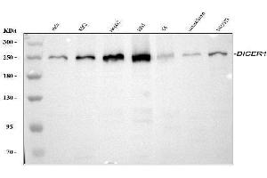 Western blot analysis of Dicer/DICER1 using anti-Dicer/DICER1 antibody (ABIN3043347).
