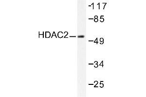 Image no. 1 for anti-Histone Deacetylase 2 (HDAC2) antibody (ABIN265455)