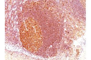 Formalin-fixed, paraffin-embedded human Tonsil stained with MALT1 Mouse Monoclonal Antibody (SPM578) (MALT1 anticorps  (AA 701-808))
