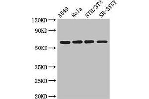 Western Blot Positive WB detected in: A549 whole cell lysate, Hela whole cell lysate, NIH/3T3 whole cell lysate, SH-SY5Y whole cell lysate All lanes: IRF5 antibody at 3 μg/mL Secondary Goat polyclonal to rabbit IgG at 1/50000 dilution Predicted band size: 57, 58, 55, 48, 18 kDa Observed band size: 57 kDa (IRF5 anticorps  (AA 214-395))