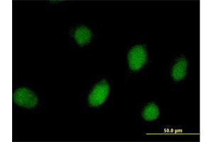 Immunofluorescence of purified MaxPab antibody to PEPP-2 on HeLa cell. (RHOXF2 anticorps  (AA 1-288))