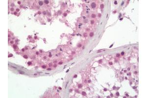Human Testis: Formalin-Fixed, Paraffin-Embedded (FFPE) (PALB2 anticorps  (AA 675-725))