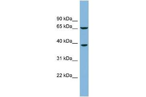 WB Suggested Anti-RLBP1L1 Antibody Titration: 0. (Clavesin 1 anticorps  (Middle Region))