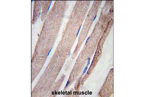 Formalin-fixed and paraffin-embedded human skeletal muscle tissue reacted with PHPT1 polyclonal antibody  , which was peroxidase-conjugated to the secondary antibody, followed by DAB staining.