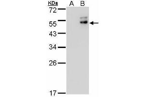 WB Image Western Blot analysis of DPF2 expression in transfected 293T cell line by DPF2 polyclonal antibody. (DPF2 anticorps  (Center))