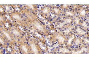 Detection of FADS2 in Mouse Kidney Tissue using Polyclonal Antibody to Fatty Acid Desaturase 2 (FADS2)