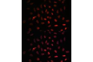 Immunofluorescence analysis of U-2 OS cells using NXT2 antibody (ABIN6133260, ABIN6144977, ABIN6144978 and ABIN6217951) at dilution of 1:100.